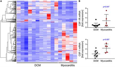 Silencing the CSF-1 Axis Using Nanoparticle Encapsulated siRNA Mitigates Viral and Autoimmune Myocarditis